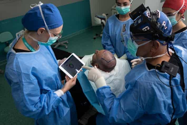 Four surgeons using a graft calculator during a hair transplant operation